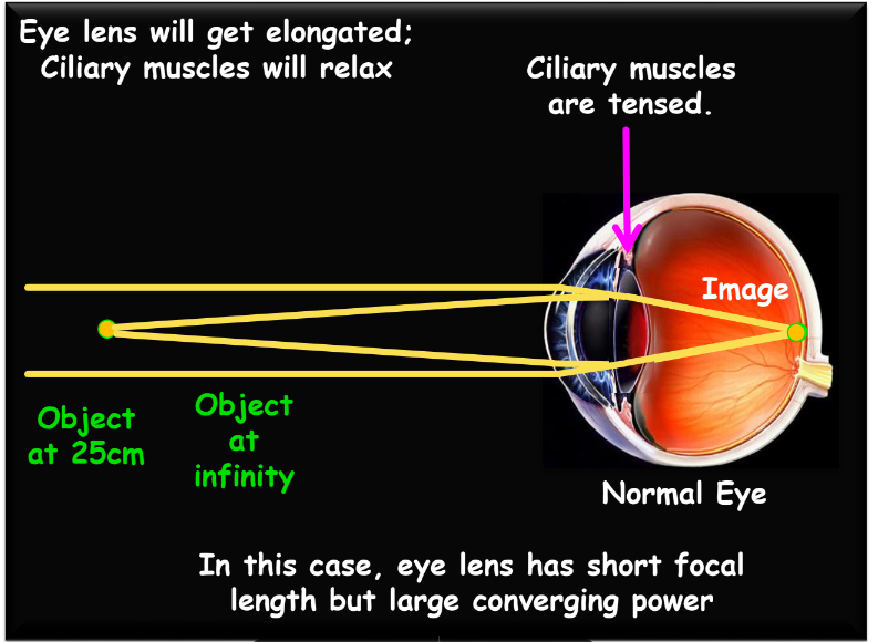 A visual representing power of accommodation from class 10 science chapter 10 The Human Eye and The Colourful World